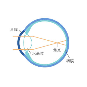 装用前（近視の状態）